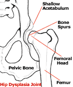 hip dysplasia in dogs x-ray picture